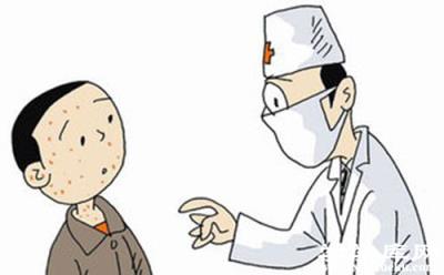 感染水痘幾天能好 水痘的癥狀和治療