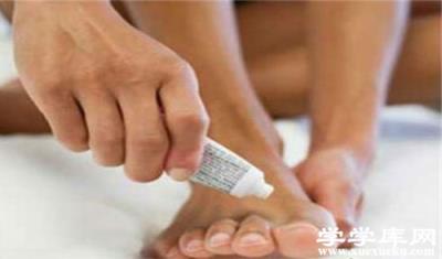 怎樣治腳氣 治療腳氣的最佳方法