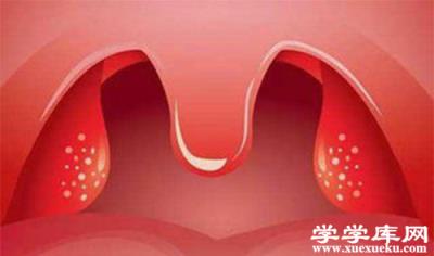 扁桃體發炎的癥狀 這5大表現中招了嗎