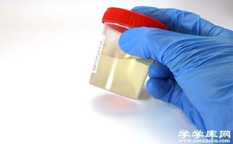 尿毒癥能活多久 尿毒癥有什么癥狀